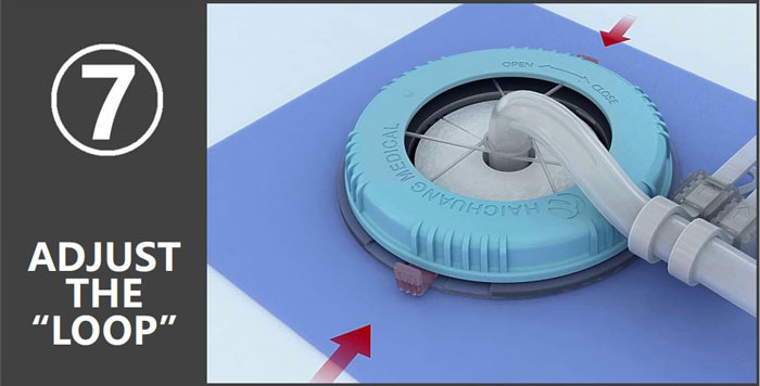 Loopixドレナージカテーテル固定具装着手順