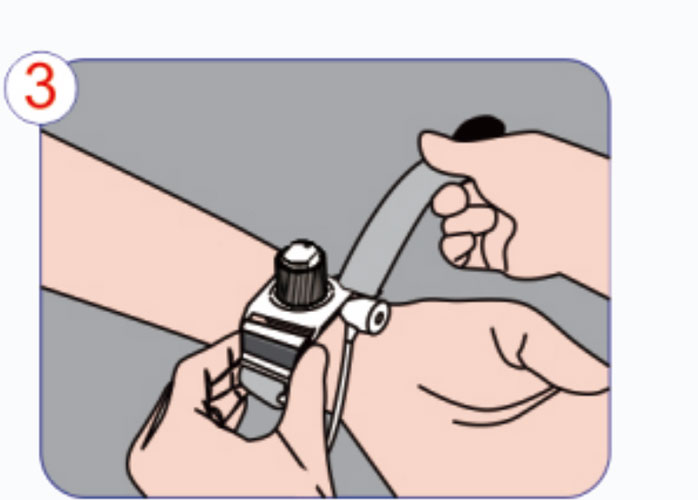 Aplicação-Procedimento-do-Dispositivo-Hemostato-da-Artéria-Radial Etapa 3