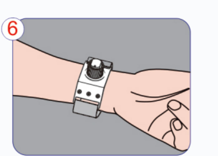 Application-Procédure-of-Radial-Artery-Hemostat-Device Étape 6