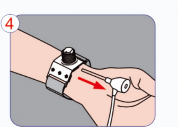 Aplicación-Procedimiento-de-Radial-Artery-Hemostat-Device Paso 4