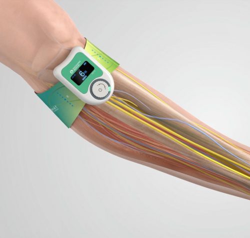 Stimolatore elettrico neuromuscolare